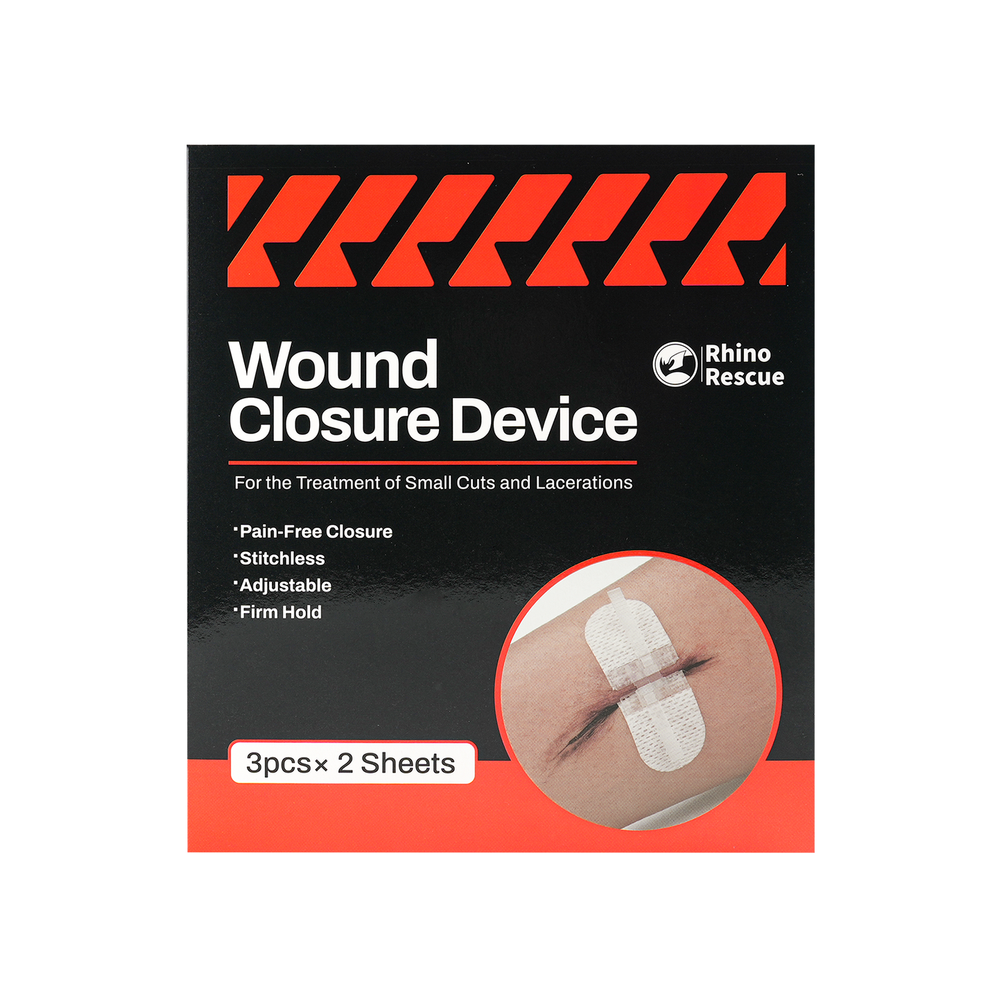 Wound Closure Device